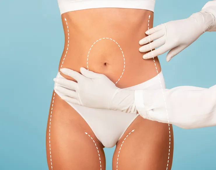 How Can CoolSculpting Be Combined with Other Body Contouring Treatments?