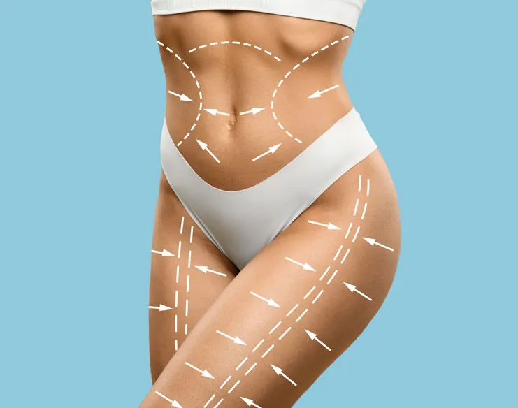 What Is Body Contouring: Options & What to Expect