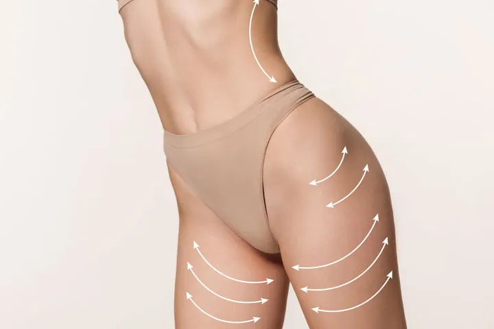 Fat reduction with CoolSculpting treatment in Singapore